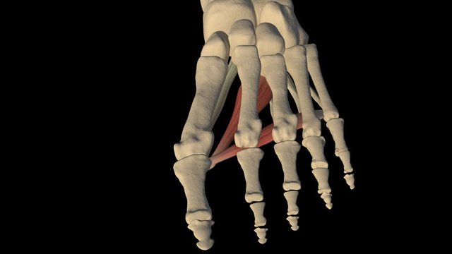 Hallux Valgus