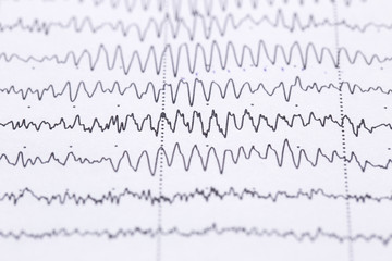 Fototapeta premium Cardiogram on a sheet of paper close-up. Texture of pulsed waves.