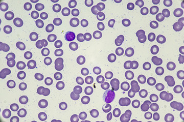 Lymphocyte (White blood cell)