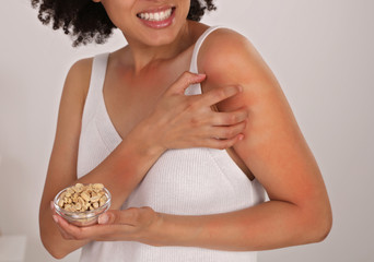 Peanut Food allergy symptoms, Irritation. Woman Scratching an itch