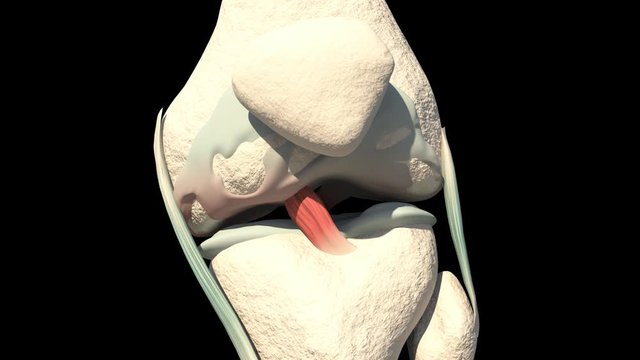 knee cartilage Lesion