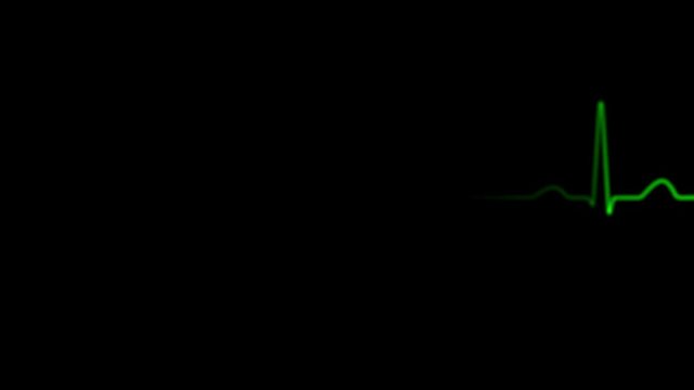 Animated EKG heart monitor display. Alpha channel included for easy background replacement.