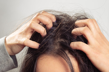 Closeup woman hand itchy scalp, Hair care concept - obrazy, fototapety, plakaty