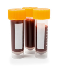 Test tubes with blood on white background