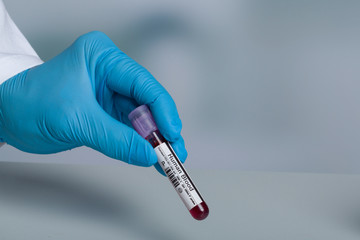 Doctor's hand with medical glove holding a blood probe