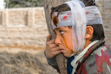 a cute injured child with sad expression and having bleeding bandage on his head