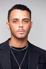 Studio Portrait Of Young Man With Skin Pigmentation Disorder Looking At Camera