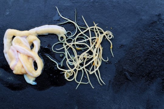 Invertebrate Zoology and Hybrobiology,Threadworm,Nematodes on a black background