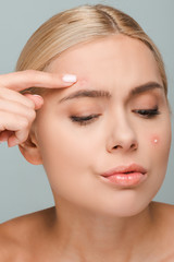 upset girl pointing with finger at face with acne isolated on grey