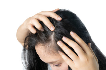 Fototapeta premium Young Asian women worry about problem hair loss,head bald,dandruff.hair loss problem and Hair treatment concept