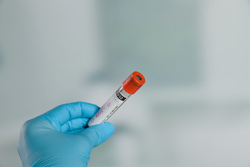 Doctor's hand with medical glove holding a blood probe. in front of a lab