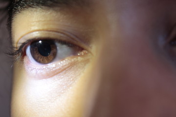 Dilated pupil close up
