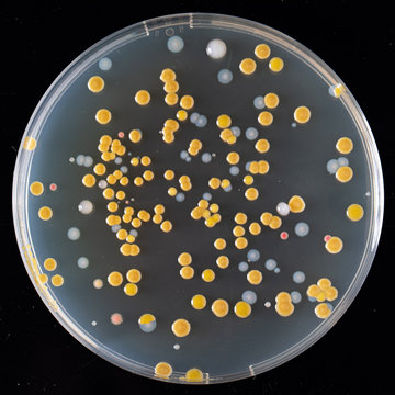 Agar culture of various bacteria on agar in a Petri dish