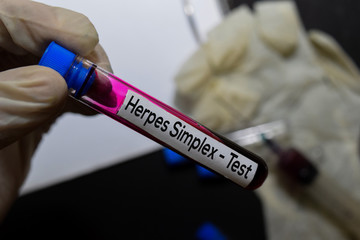 Obraz premium Herpes Simplex - Test with blood sample. Top view isolated on office desk. Healthcare/Medical concept