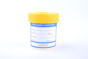 bottles of urine test sample