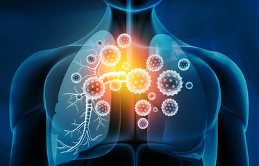 Viral lung infections, lung infection conept. 3d illustration.