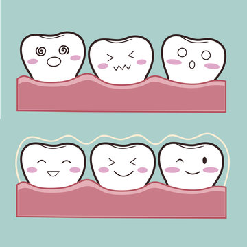 Vector illustration of a Silicon exerciser for the teeth. Invisible braces on cartoon teeth.  Characters can be used to advertise a transparent bracket in a dental clinic.