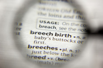 The word or phrase Breech birth in a dictionary.