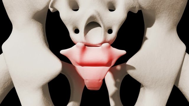 Coccydynia