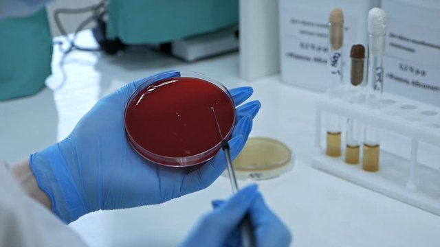 Bacteriological crops of various bacteria and microorganisms are carried out by laboratory staff in gloves. Sowing on special Petri dishes using a special needle. laboratory