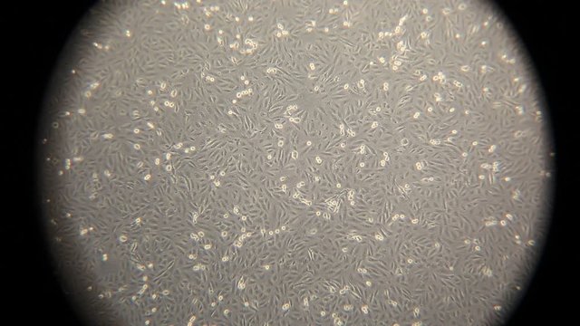 Focusing with a microscope on human cancer cells for scientific studies