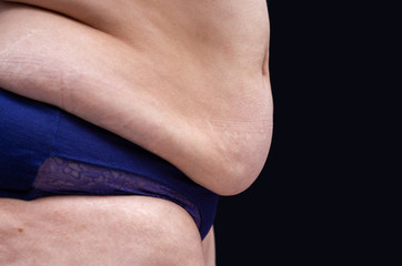 Fat female belly with cellulite