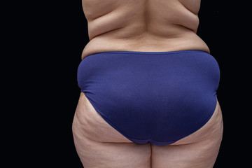 fat ass woman with cellulite