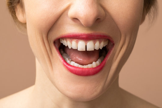 Unrecognisable Woman Laughing