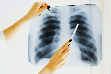 Doctor girl holding x-ray of lungs.