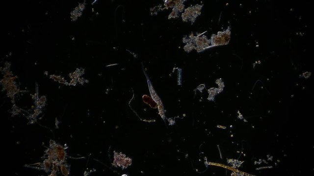 microorganism in pond water under microscope unicellular organisms