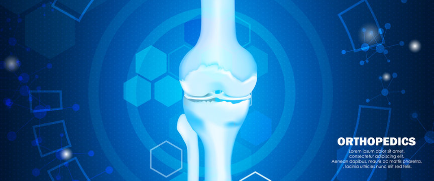 Medical Orthopedic And The Future Of The Smart Hospital. Treatment For Orthopedics Traumatology Of Knee Bones And Joints Injury. Medical Presentation, Hospital. Vector Illustration