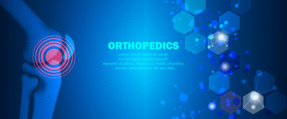 Medical orthopedic and the future of the smart hospital. Treatment for orthopedics traumatology of knee bones and joints injury. Medical presentation, hospital. Vector illustration
