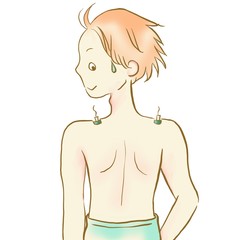 Man receiving moxibustion treatment1, alternative medicine