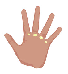 マメができた手