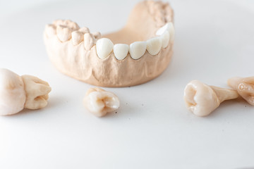Fototapeta na wymiar Close-up on plaster model of artificial jaw and teeth on the white background. Concept of art in aesthetic dentistry and veneers