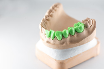 Close-up on plaster model of artificial jaw with teeth painted in green on the white background. Concept of aesthetic dentistry and implantation