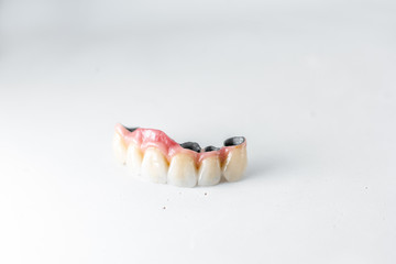 Close-up on dental crowns on the white background. Concept of prosthetics and implantation in dentistry