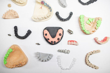 Various of artificial jaw models with dental implants and crowns on the white background. Concept of aesthetic dentistry and implantation technology