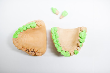 Plaster models of artificial jaw with teeth painted in green on the white background. Concept of aesthetic dentistry and implantation