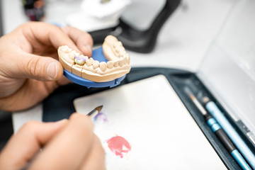 Dental technician coloring dental prosthesis with a paint brush at the laboratory, close-up view. Concept of implantats producing