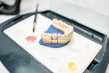 Colored dental prosthesis with a paint brush at the working place in the laboratory. Concept of implantats producing and dental art