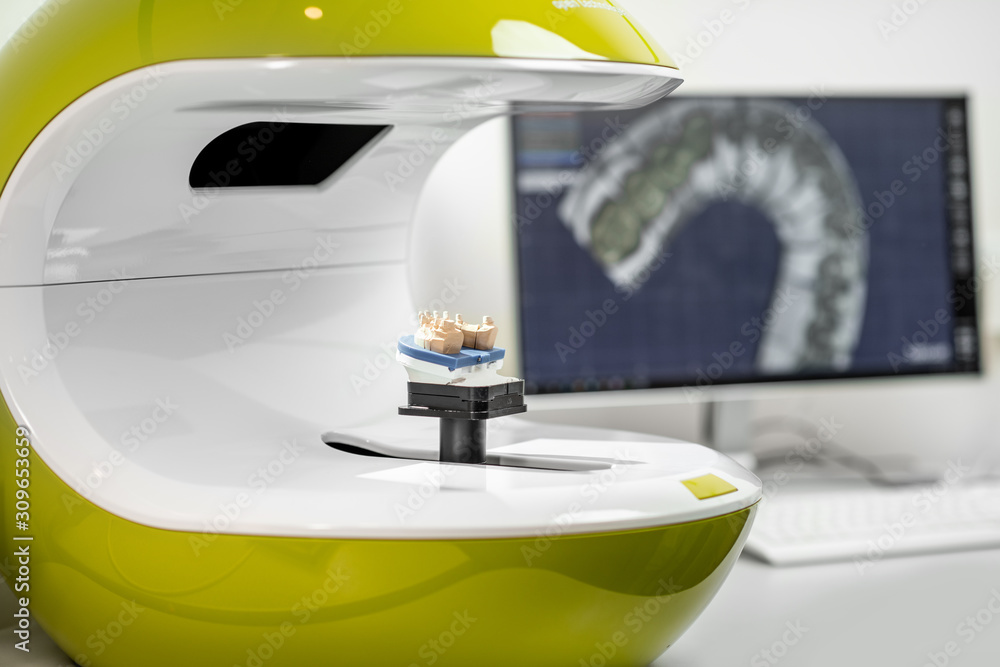 Poster scanning jaw model on the 3rd scanner in the laboratory, for the manufacture of dentures or implants