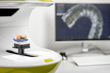 Scanning jaw model on the 3rd scanner in the laboratory, for the manufacture of dentures or implants, computer with imprints on the background