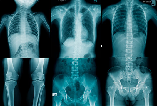 collection human x-ray image