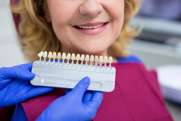 dentist checking the level of teeth whitening for mature woman