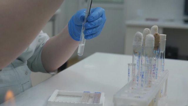 A woman in a medical laboratory checks the reaction of staph bacteria on different substances and antibiotics.