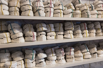 Dental gypsum models of jaws in dentist's office.