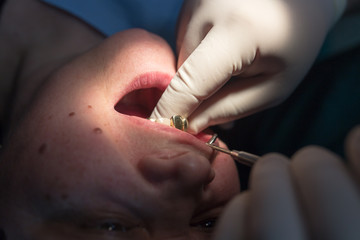 The dentist works with the client in the clinic