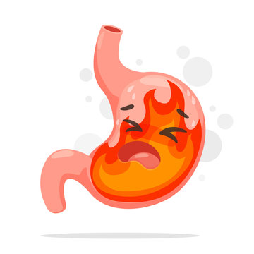 Cartoon Stomach Suffering From Acid Reflux. A Stomach That Burning Like A Fire From Acid Reflux.