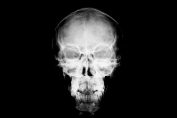 X-ray of head / Many others X-ray images in my portfolio.